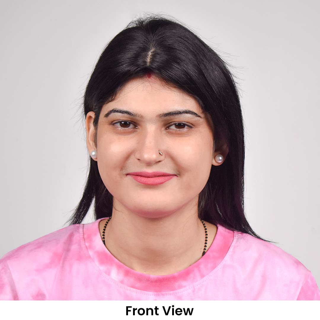 T-Part Silk Base Hair Topper – Centre Part Crown Coverage, 10 Inch, 2.8×3.2 Base