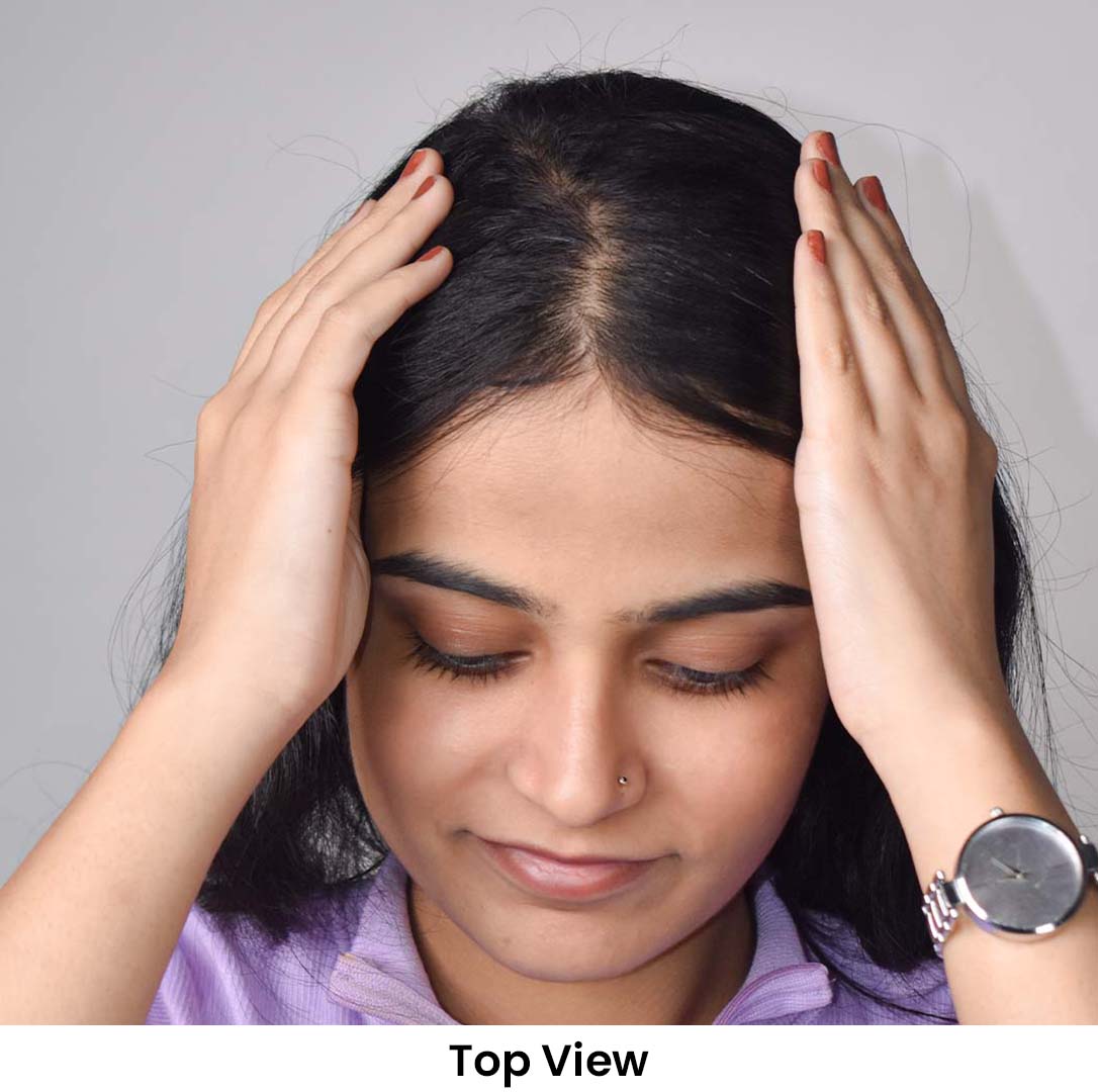 Lace Hair Topper – 16 Inch, Crown & Part Line Coverage for Thinning Hair