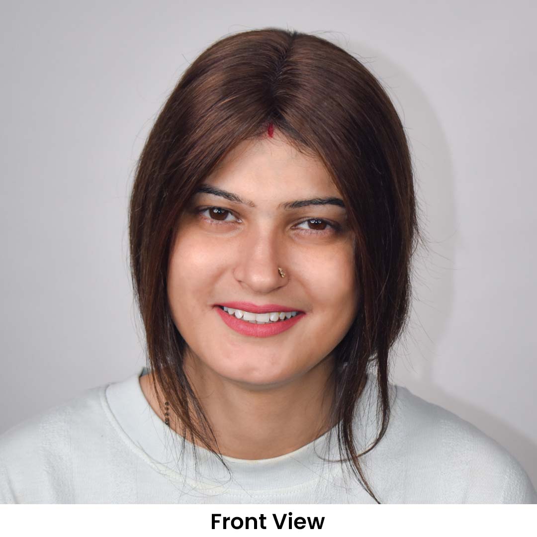 Swiss Lace Hair Topper for Women 2.6*4.5inch