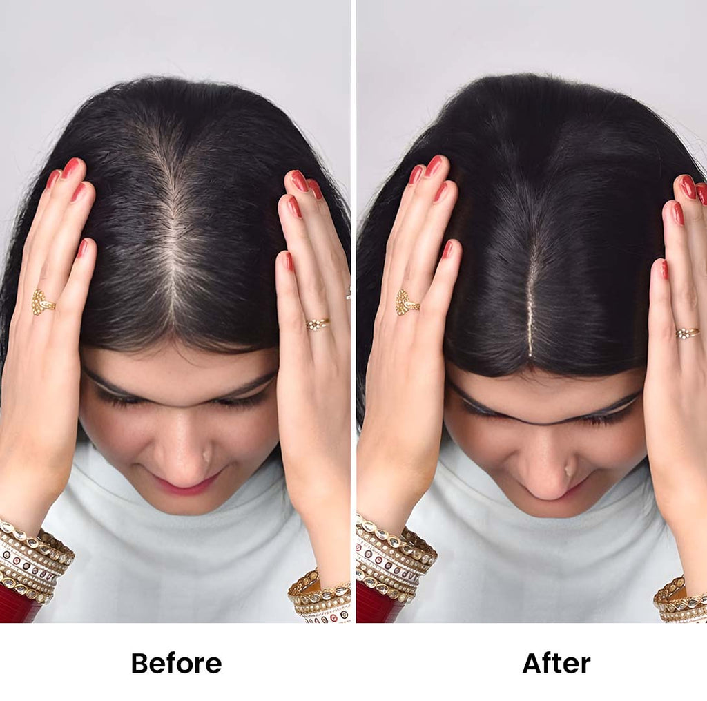 T-Part Silk Base Hair Topper – Centre Part Crown Coverage, 12 Inch, 2.8×3.2 Base