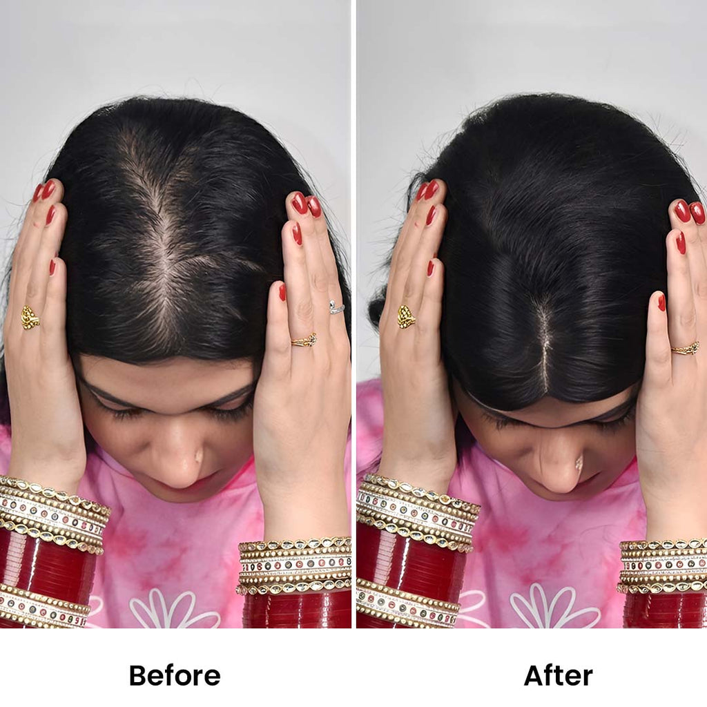 T-Part Silk Base Hair Topper – Centre Part Crown Coverage, 10 Inch, 2.8×3.2 Base