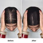 Silk Base Hair Topper – Large Crown Coverage for Severe Hair Loss, 4.5×6 Base