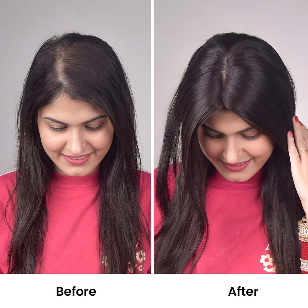 Silk Base Hair Topper – Mid Crown Coverage for Thinning Hair, 3×5 Base