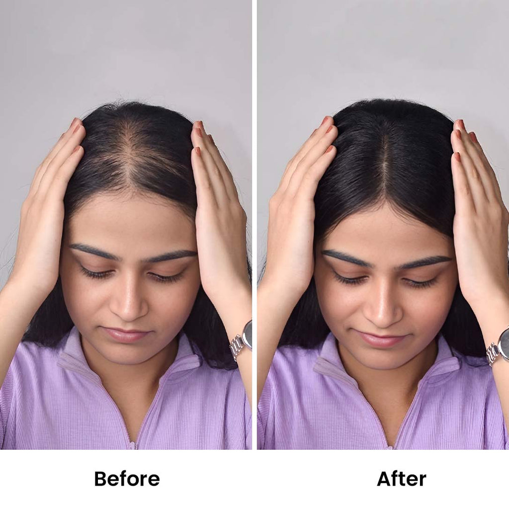 Lace Hair Topper – 16 Inch, Crown & Part Line Coverage for Thinning Hair
