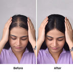 Lace Hair Topper – 16 Inch, Crown & Part Line Coverage for Thinning Hair