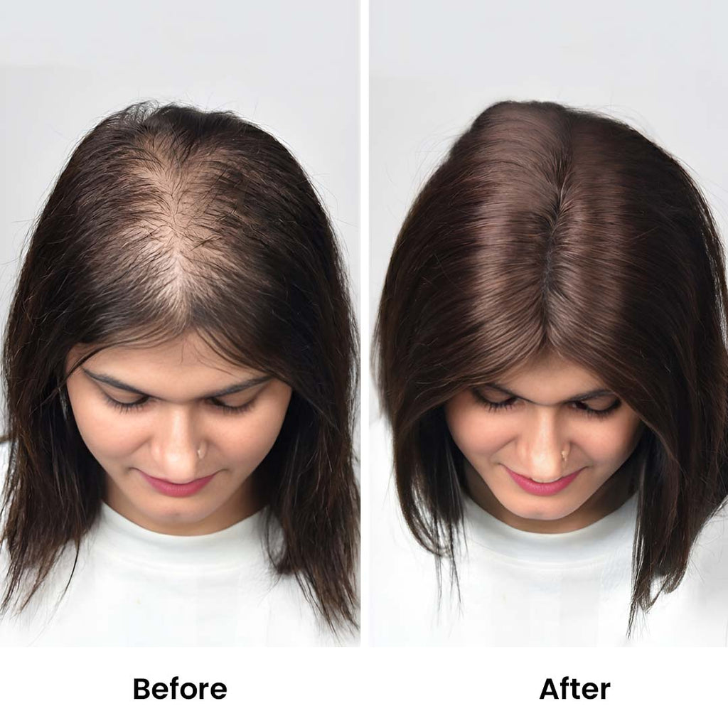 Swiss Lace Hair Topper for Women 2.6*4.5inch