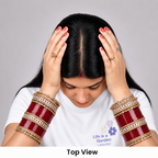 Silk Base Hair Topper – Crown Scalp 2.5×5 Base