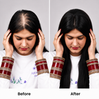 Silk Base Hair Topper – Crown Scalp 2.5×5 Base