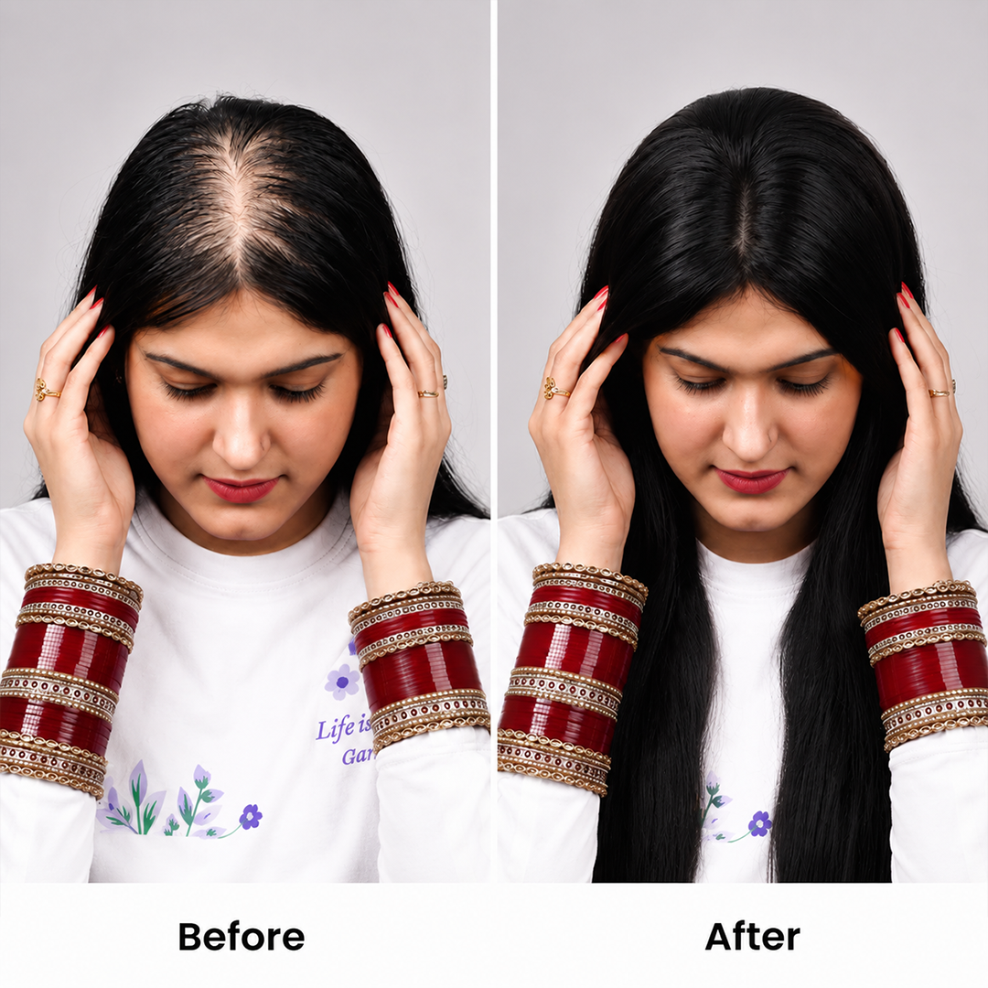 Silk Base Hair Topper – Crown Scalp 2.5×5 Base