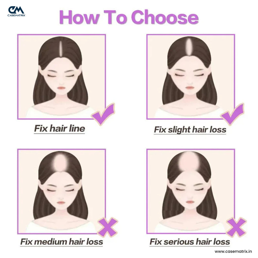 Silk Base Hair Topper – Mid Crown Coverage for Thinning Hair, 3×5 Base