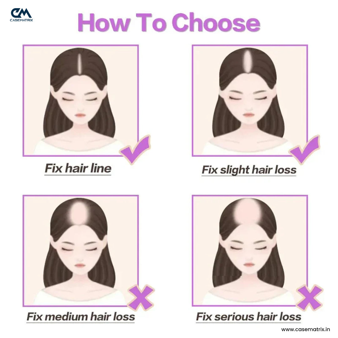 Silk Base Hair Topper – Mid Crown Coverage for Thinning Hair, 3×5 Base