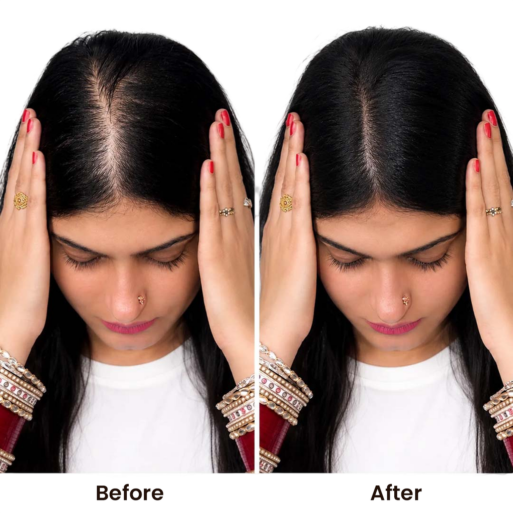 Invisible Human Hair Lace Topper