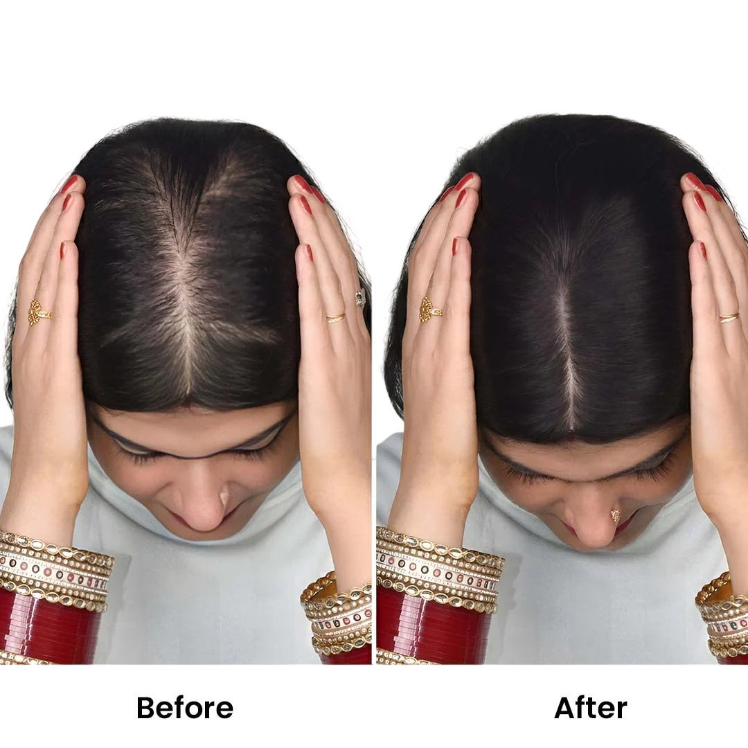Silk Base Human Hair Topper 4.5*6Inc