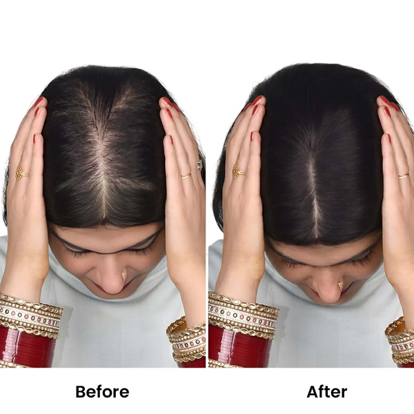 Silk Base Human Hair Topper 4.5*6Inc