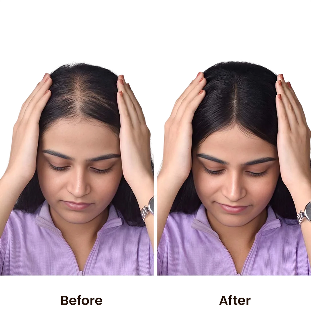 Invisible Human Hair Lace Topper