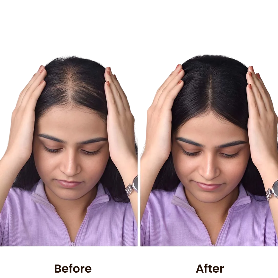 Invisible Human Hair Lace Topper