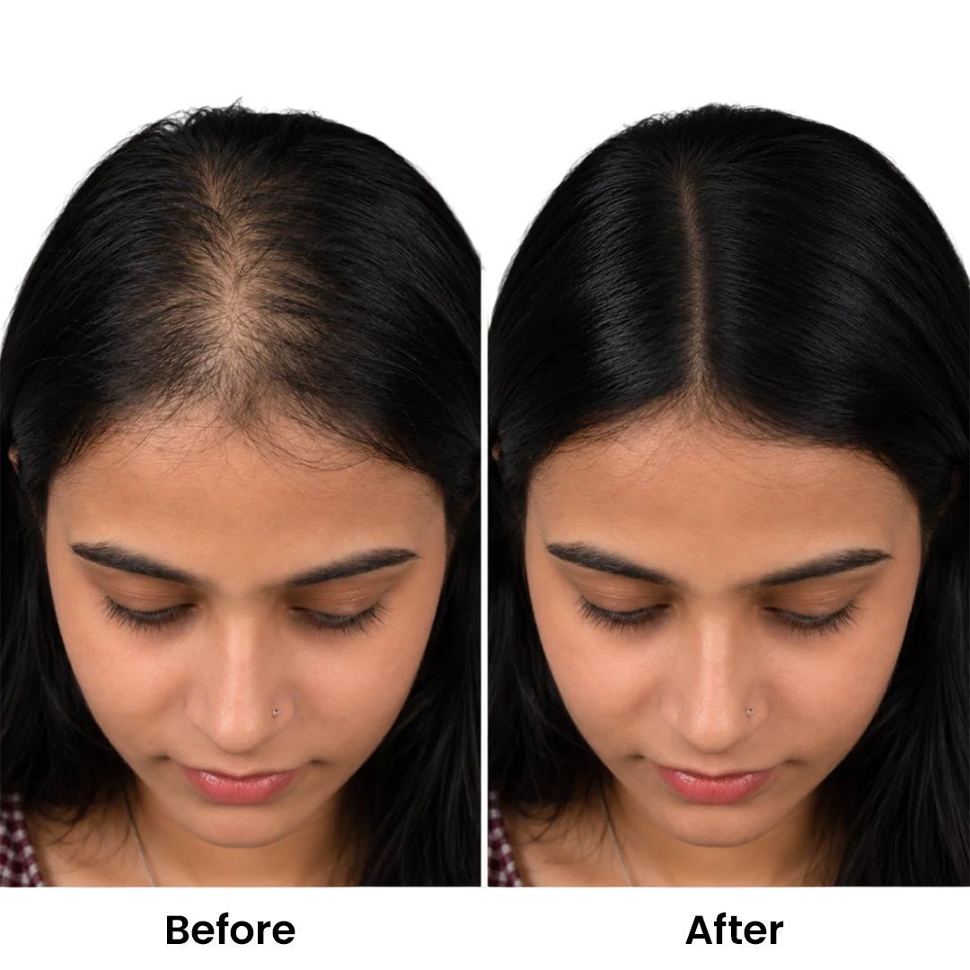 Silk Base Human Hair Topper 1.5*5Inc