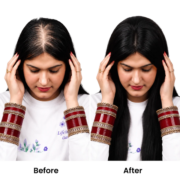 Silk Base Human Hair Topper 2.5*5Inc