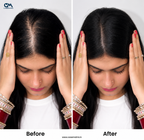 Lace Hair Topper – 18 Inch, Crown & Part Line Coverage for Thinning Hair