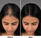 Silk Base Hair Topper – Narrow Crown 1.5×5 Base